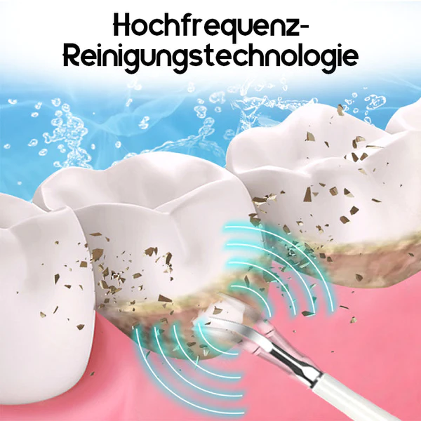 Ceoerty™ SonicSmile Ultraschall-Zahnreiniger - Image 5