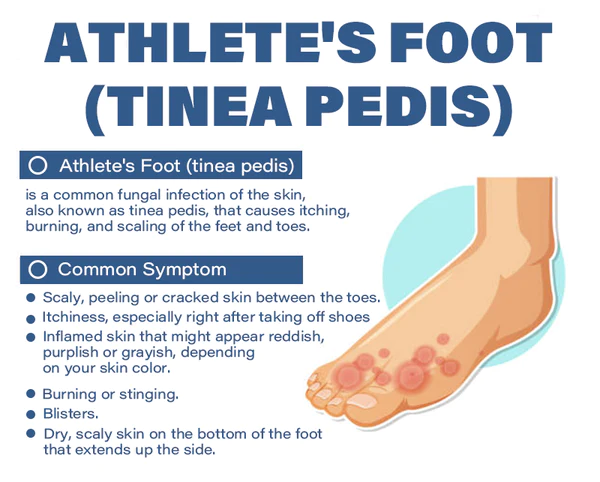 Furzero™ Medizinisches Nagelpilz-Fußspray - Image 6