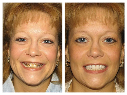 Unpree TEETH Mouthwash - Image 6