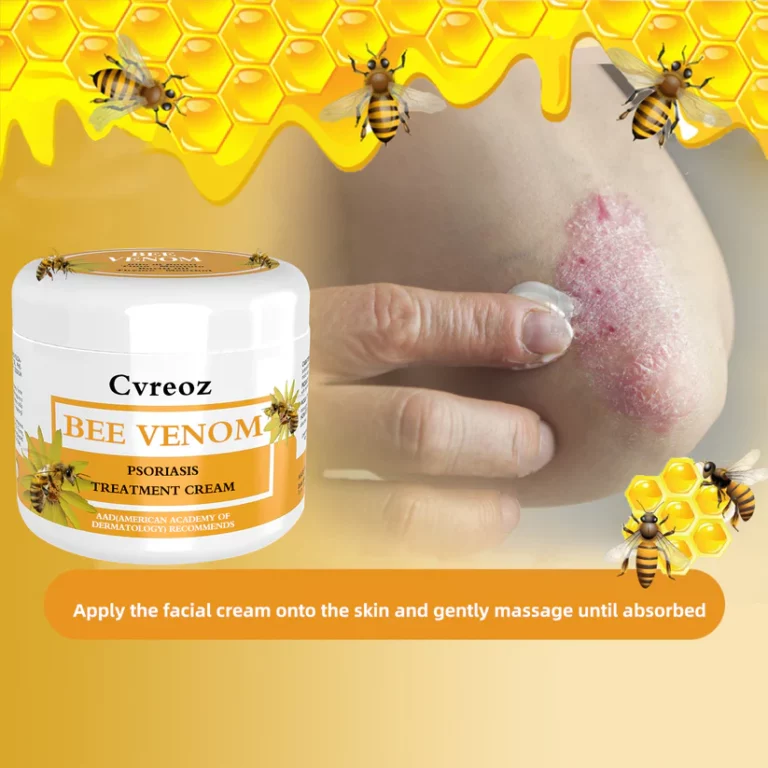 Lotmay™ Bee Venom Psoriasis Treatment Cream - Image 3
