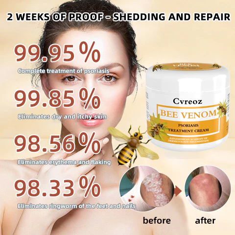 Lotmay™ Bee Venom Psoriasis Treatment Cream - Image 7