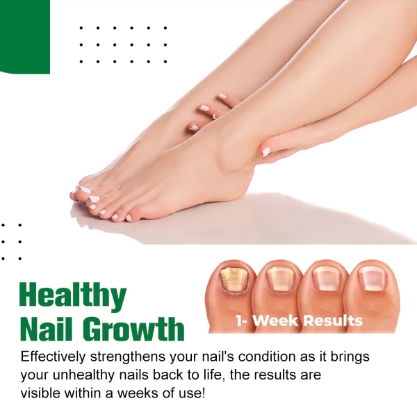 HerbNail™ Toenail Fungus Care Antibacterial Solution - Image 3