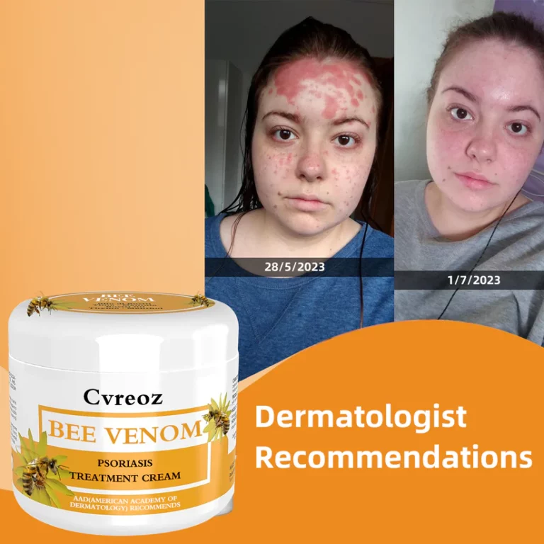 Lotmay™ Bee Venom Psoriasis Treatment Cream - Image 4