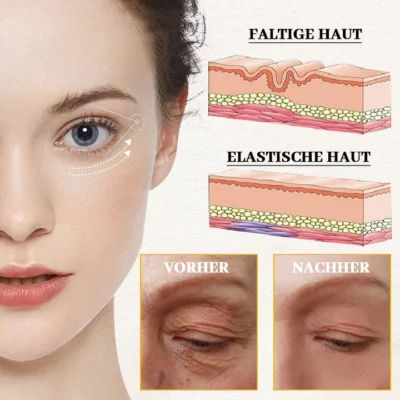 Biancat™ AgeDefy Rejuven Augen-Essenz - Image 6