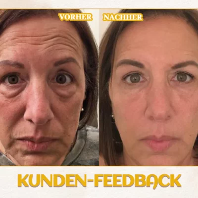 Biancat™ AgeDefy Rejuven Augen-Essenz - Image 4