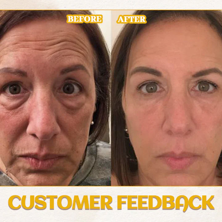 Fivfivgo™ AgeDefy Rejuven Eye Essence - Image 3