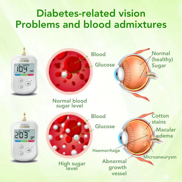 Oveallgo™ Inhalateur de contrôle glycémique à base de plantes InsuLuxe - Image 5