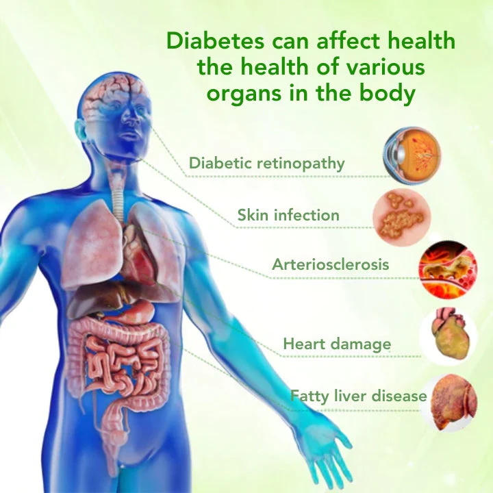 Fivfivgo™ InsuLuxe Herbal Glycemic Control Inhaler - Image 4