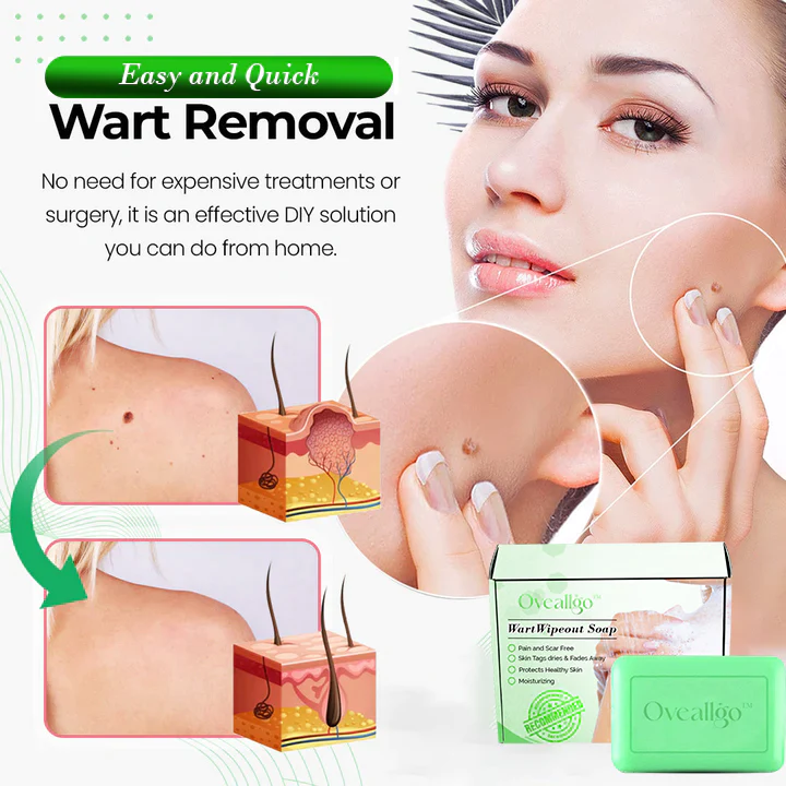 Fivfivgo™ WartWipeout Seife - Image 2