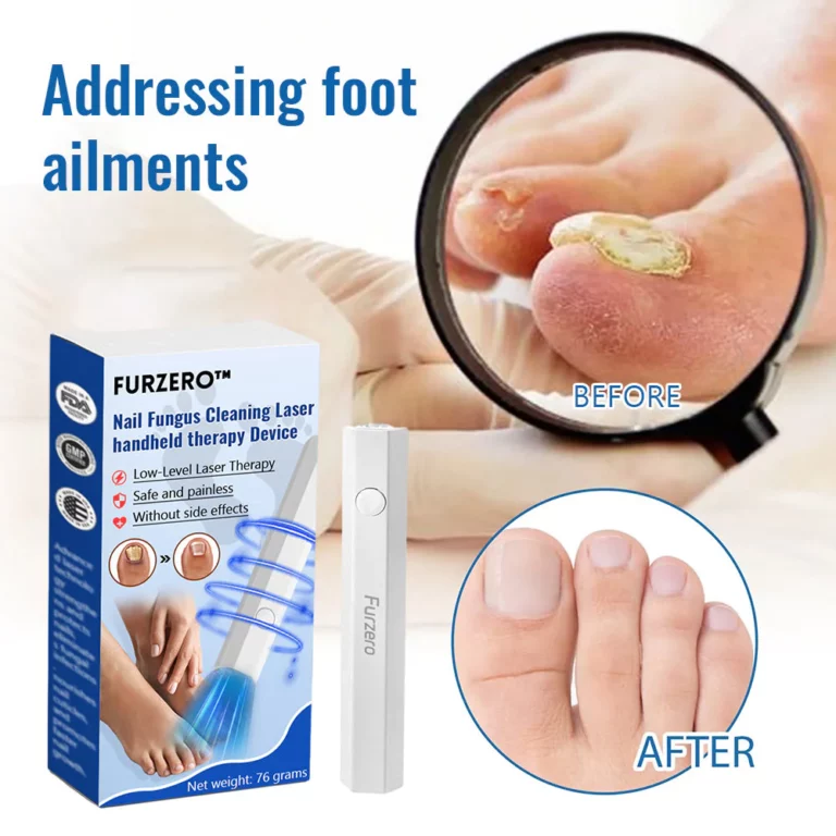 Furzero™ Toenail Fungus Laser Treatment Devices - Image 3