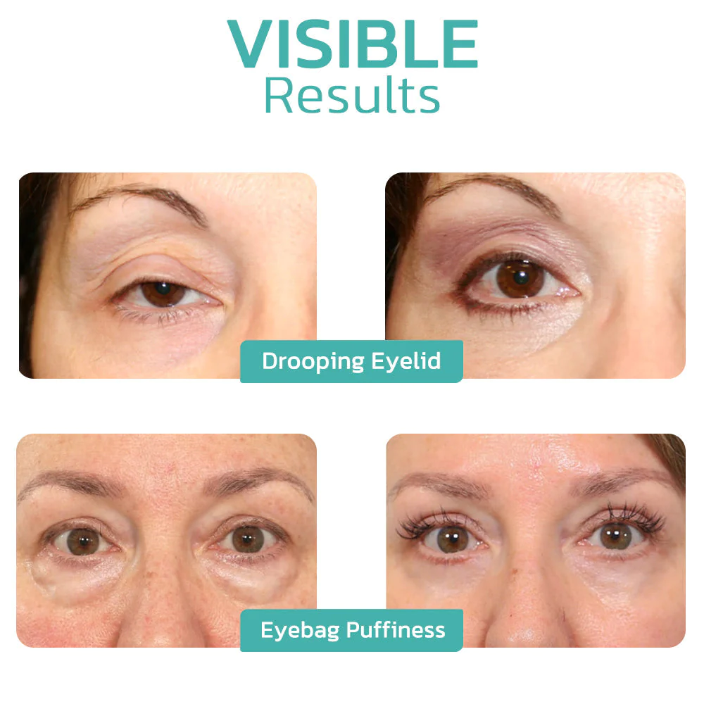 Fivfivgo™ CELYN Peptid-Straffungs-Augencreme - Image 5