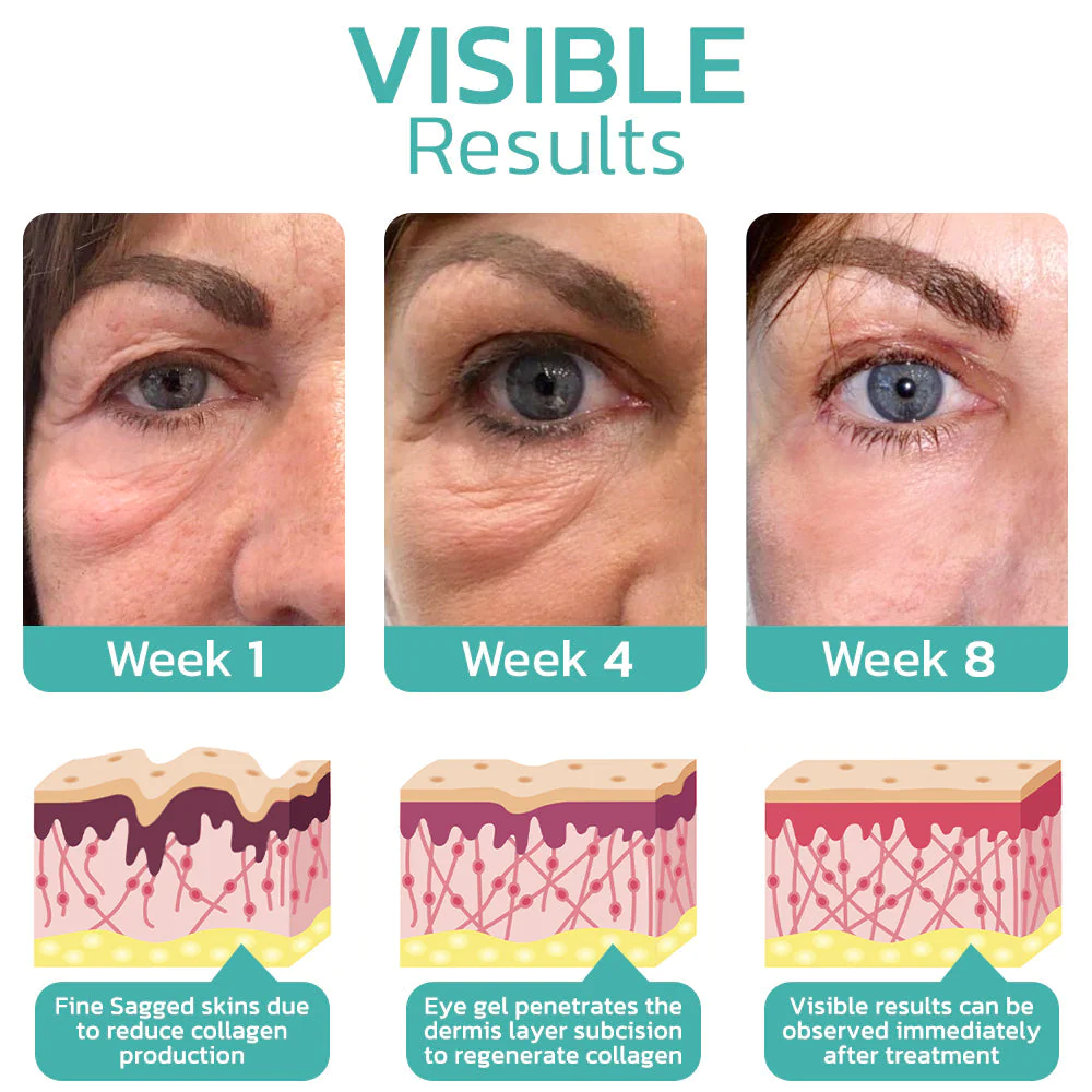 Fivfivgo™ CELYN Peptid-Straffungs-Augencreme - Image 4