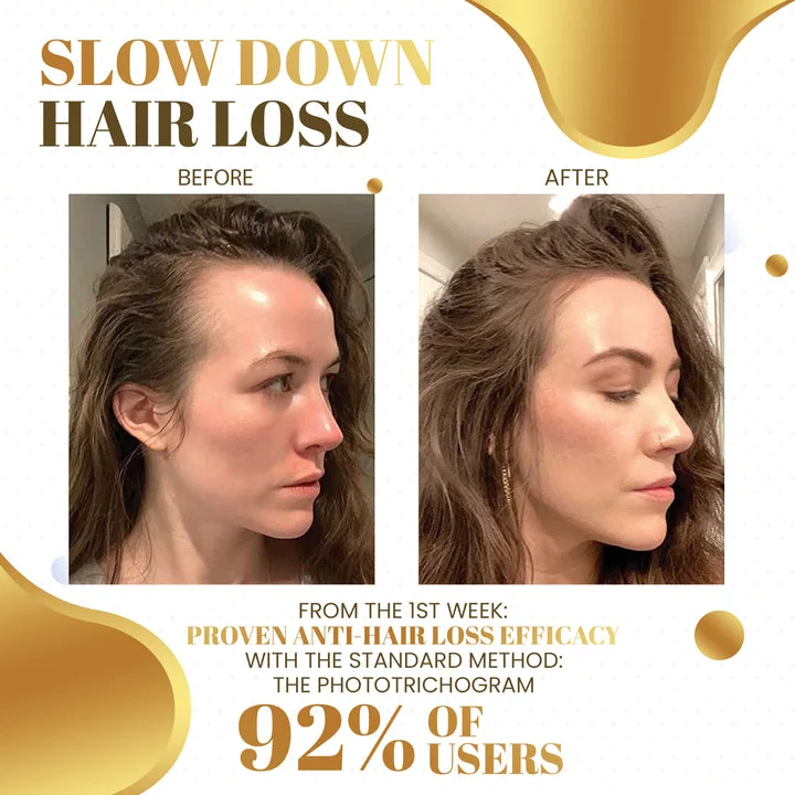 KISSHI™ Biotin Hair Growth Roll-On Massage Essence - Image 4