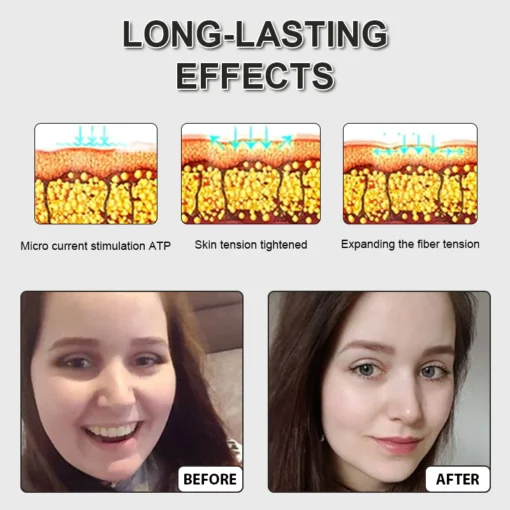 Seurico™ Chic Face Lift Skin Tightening Chain Device - Image 7