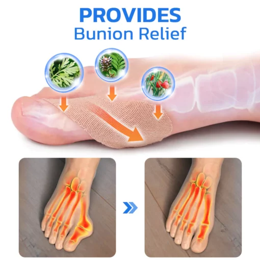GFOUK™ ToebeJoin Correct Pression Patch - Image 8