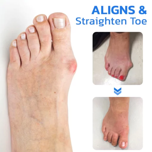 GFOUK™ ToebeJoin Correct Pression Patch - Image 7