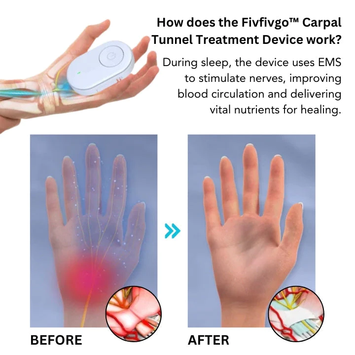 Fivfivgo™ Carpal Tunnel Treatment Device - Image 6