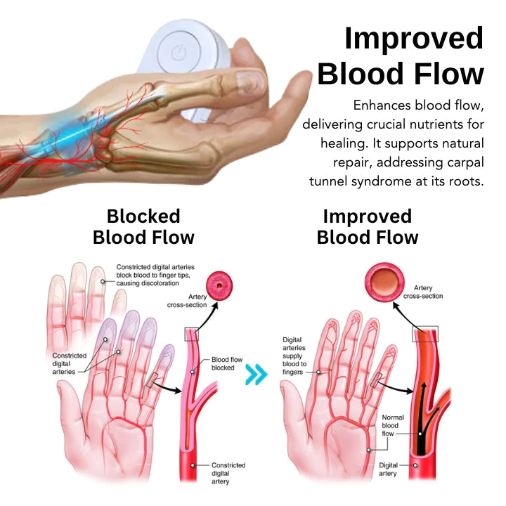Fivfivgo™ Carpal Tunnel Treatment Device - Image 5