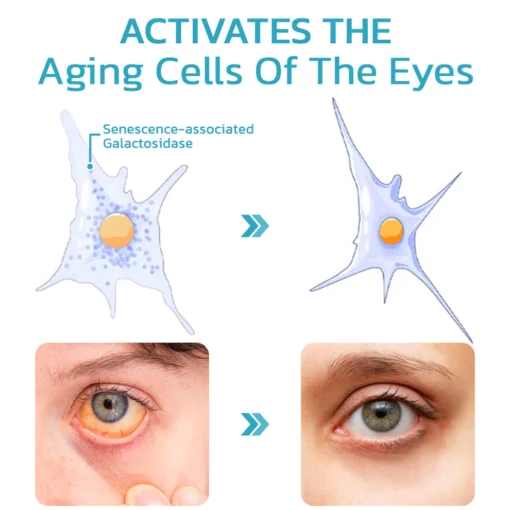 Ourlyard™ FocusHeal Vision Schmiermittel Tränen Augentropfen - Image 4