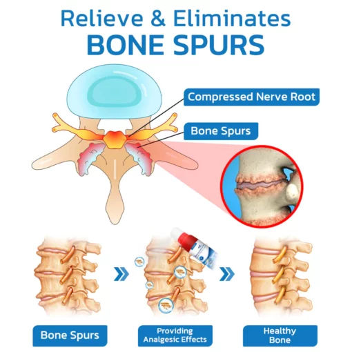 GFOUK™ BonespurHeal Shark Collagen Spray - Image 6