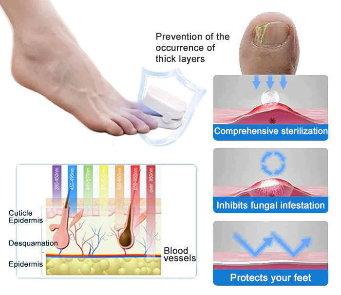 Ourlyard™ Powerful Light Therapy Device for Treating Nail Disorders - Image 8