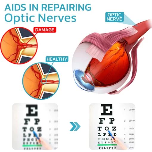 Ourlyard™ FocusHeal Vision Schmiermittel Tränen Augentropfen - Image 7