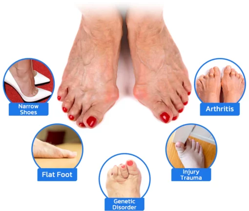 GFOUK™ ToebeJoin Correct Pression Patch - Image 5