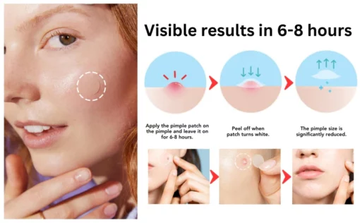 Oveallgo™ Nighttime Acne Patch - Image 8
