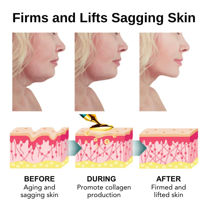 Fivfivgo™ VorSculpt V-Gesichtsformungsgerät - Image 5