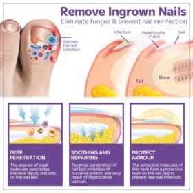 Furzero™Anti-fungal Nail Spray - Image 6