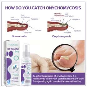 Furzero™Anti-fungal Nail Spray - Image 2