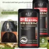 Ginger Plant Extract Anti-Hair Loss Hair Shampoo