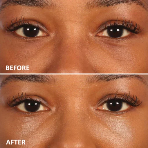 Seurico™ Eyelighter Concentrate Eye Serum - Image 7