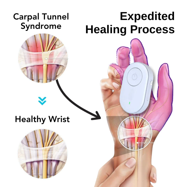Fivfivgo™ Carpal Tunnel Treatment Device - Image 3