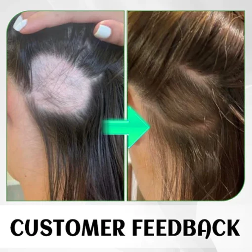 Fivfivgo™ FolliHerb Hair Growth Spray - Image 5