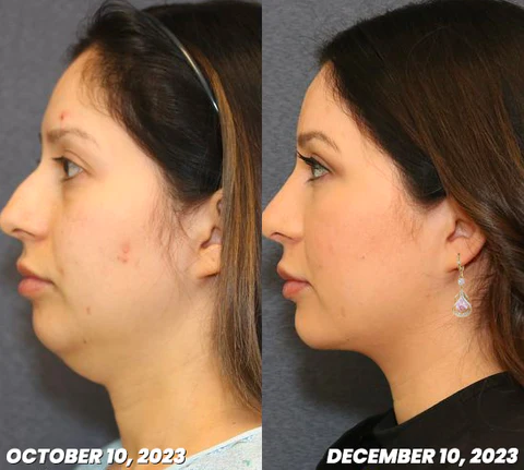 CZTICLE™ Magnetogen Ohrringe für den Lymphfluss - Image 6