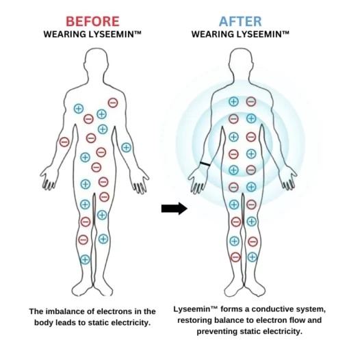 Lyseemin™ Anti-Static Electricity Bracelet - Image 6