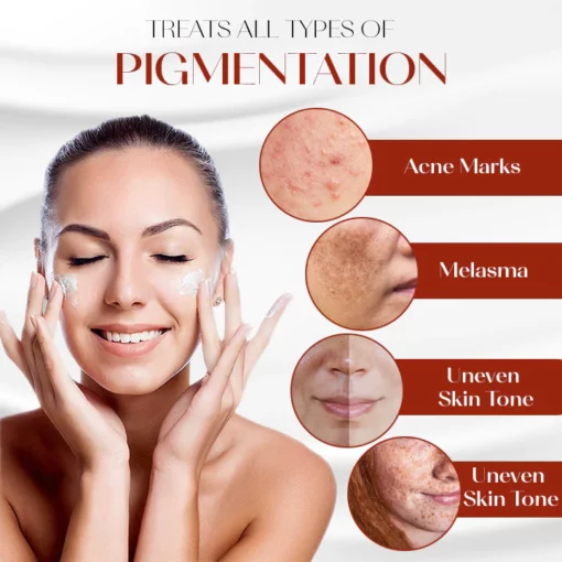 Oveallgo™ ProX Dark Spot Corrector Cream - Image 7