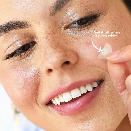 Oveallgo™ Nighttime Acne Patch - Image 7