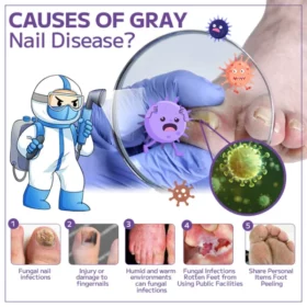 Furzero™Anti-fungal Nail Spray - Image 4