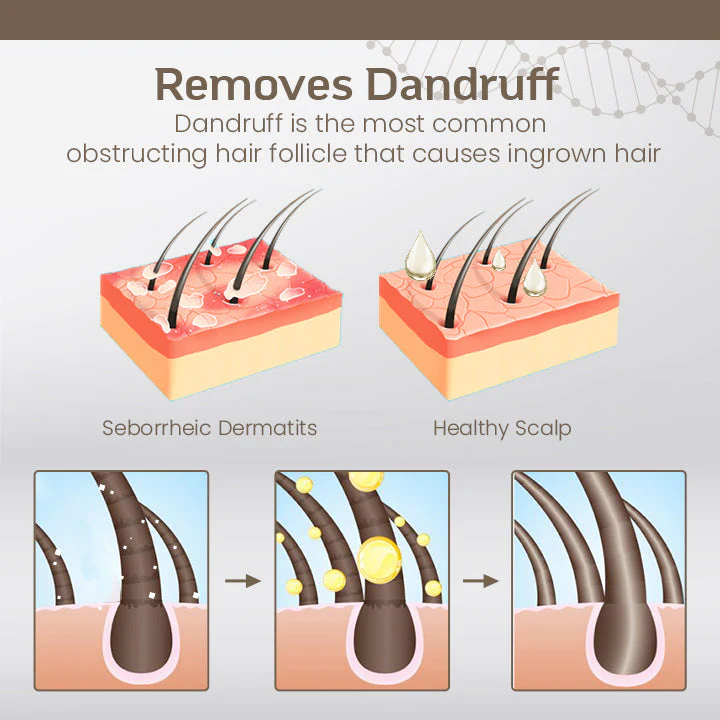 LIMETOW™ Hair Regrowth Treatment Spray - Image 8