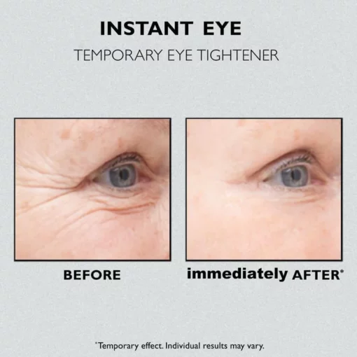 Instant Eye Temporary Eye Tightener - Image 3