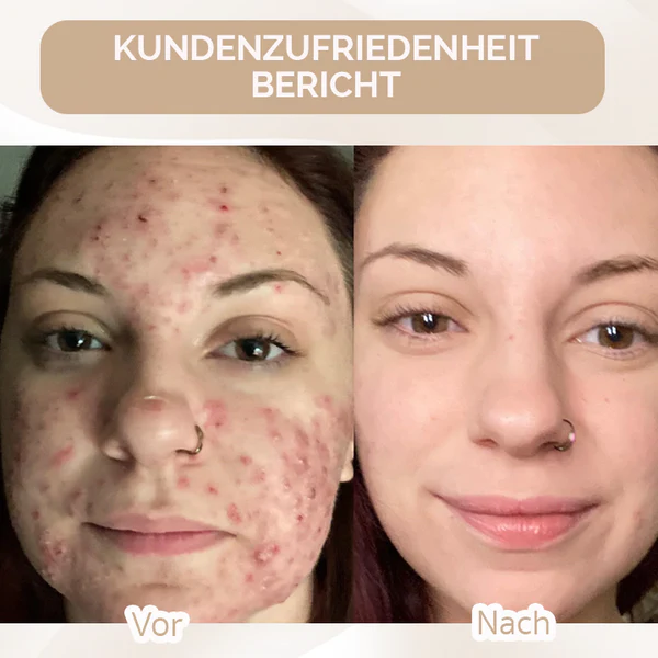 Oveallgo™ Super Coverage Foundation mit Polierpinsel - Image 5