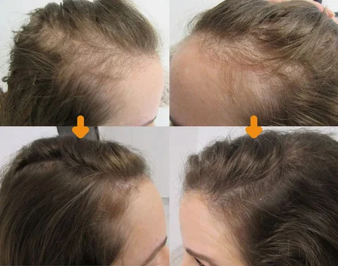 Moonbiffy™ Biotin Premium Hair Growth Serum - Image 6