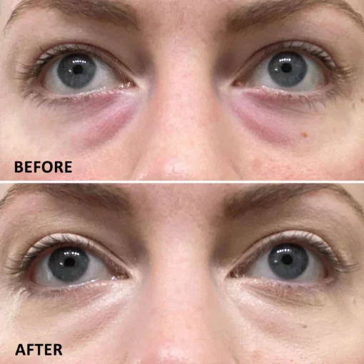 Seurico™ Eyelighter Concentrate Eye Serum - Image 4