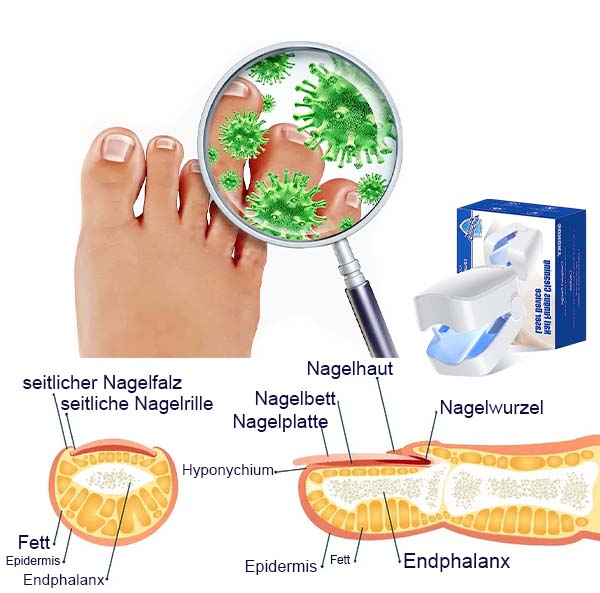 Furzero™ Nail Fungus Laser Therapy Device - Image 7