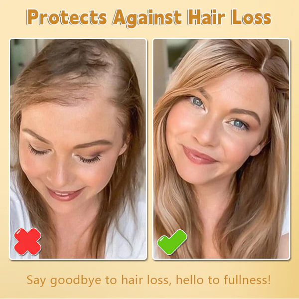 Lotmay™ Biotin Premium Hair Growth Serum - Image 4