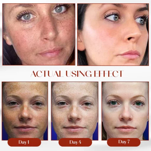 Oveallgo™ ProX Dark Spot Corrector Cream - Image 6