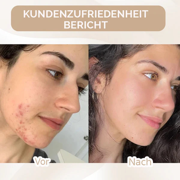 Oveallgo™ Super Coverage Foundation mit Polierpinsel - Image 7