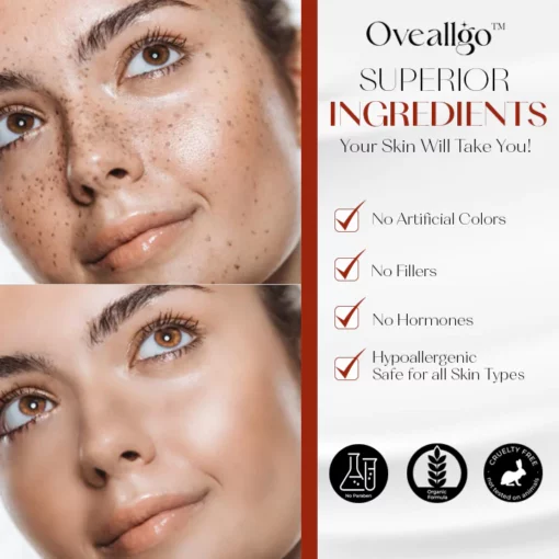 Oveallgo™ ProX Dark Spot Corrector Cream - Image 4